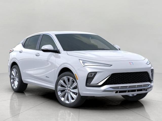 2026 Buick Envista Vehicle Photo in APPLETON, WI 54914-8833